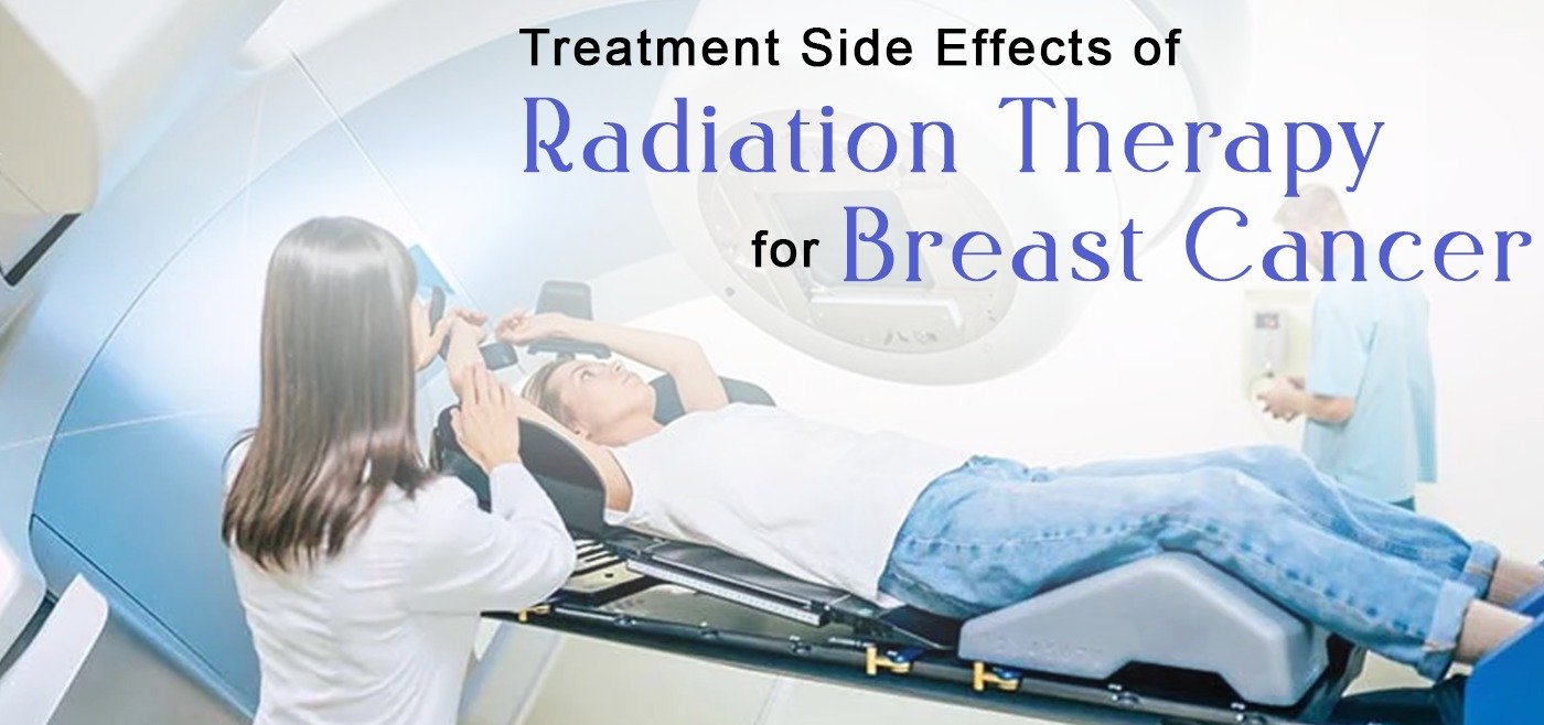 Treatment Side Effects of Radiation Therapy for Breast Cancer - Delhi ...